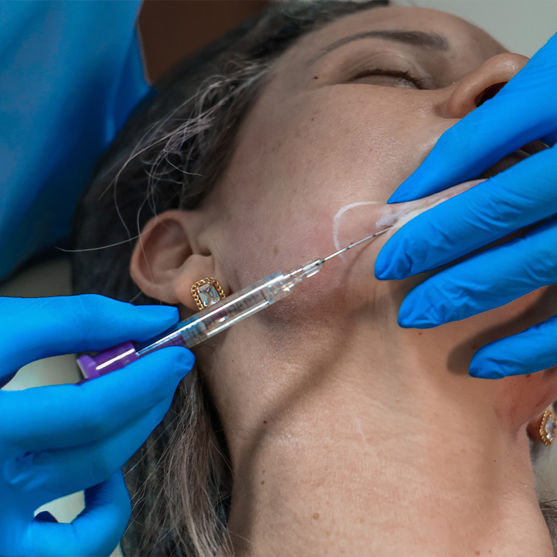 Curso-Harmonização-Facial-06