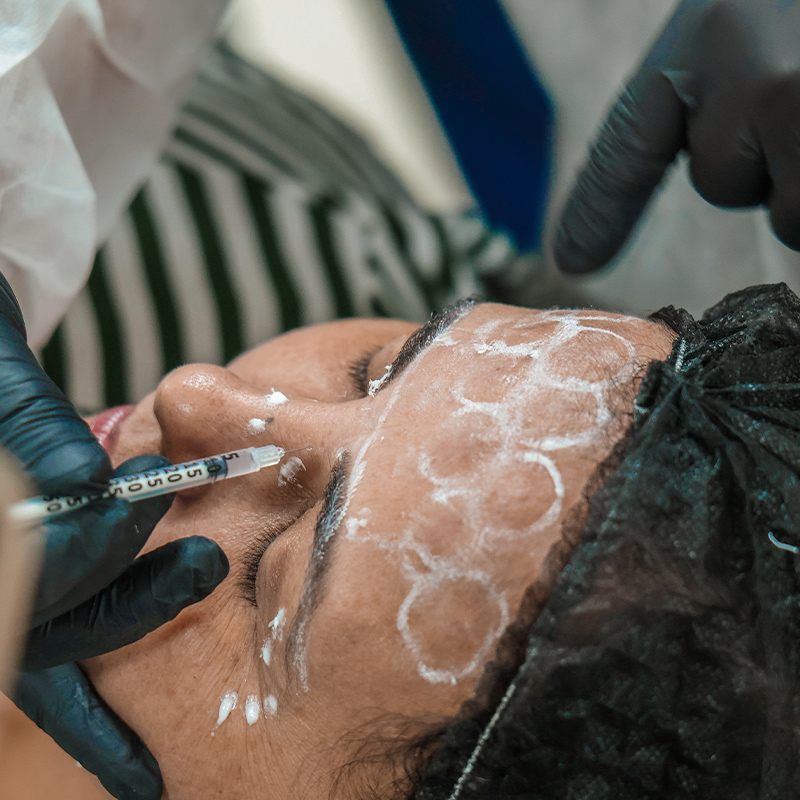 Curso-Harmonização-Facial-08