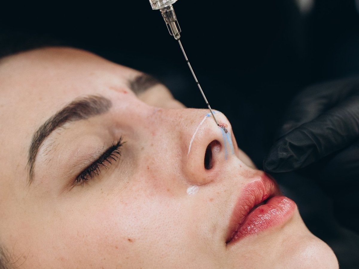 Preenchimento nasal